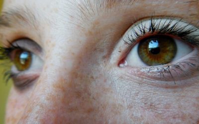 Le cause dell’ipovisione