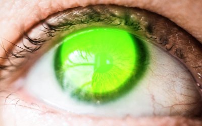 Cheratocono: approfondimento sul Cross-linking corneale – Prima parte